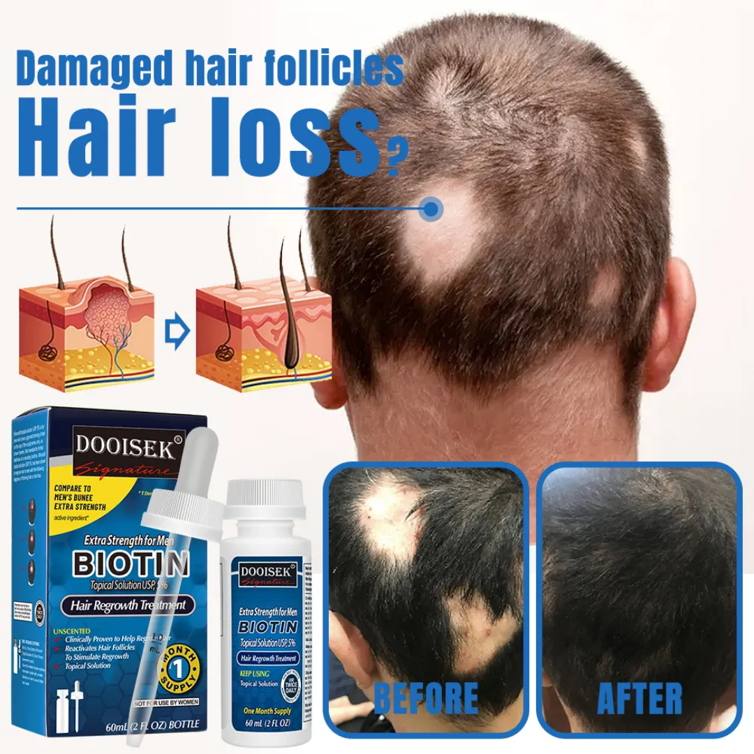 Biotine: Topical solution anti hair
